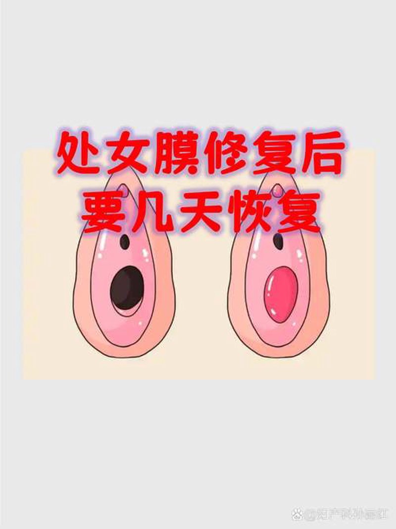 杭州私密整形妇科医院:守护女性健康的小贴士